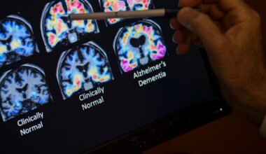 Demenz-Frühdiagnose: Erster Alzheimer-Bluttest zugelassen | Leben & Wissen