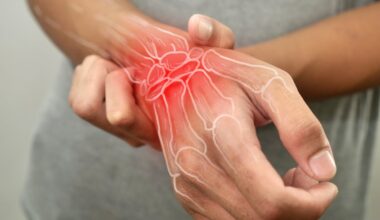 Rheumatoide Arthritis: Wenn Darmmikroben zu Gelenk-Saboteuren werden