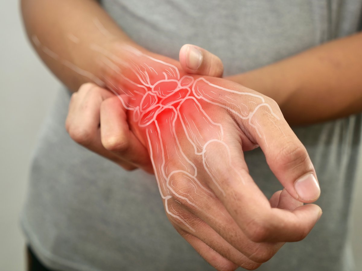 Rheumatoide Arthritis: Wenn Darmmikroben zu Gelenk-Saboteuren werden