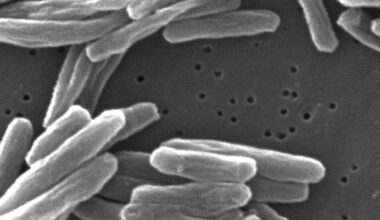 Keime schnell identifiziert: Krankheitserreger in Minuten statt Tagen erkennen