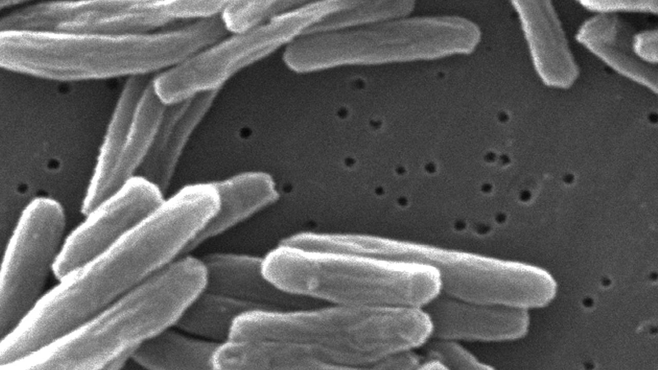 Keime schnell identifiziert: Krankheitserreger in Minuten statt Tagen erkennen