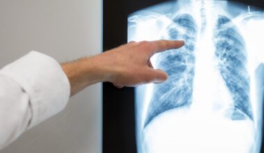 Nordrhein-Westfalen: Tuberkulose in Bonn: Was macht diese Krankheit so tückisch?