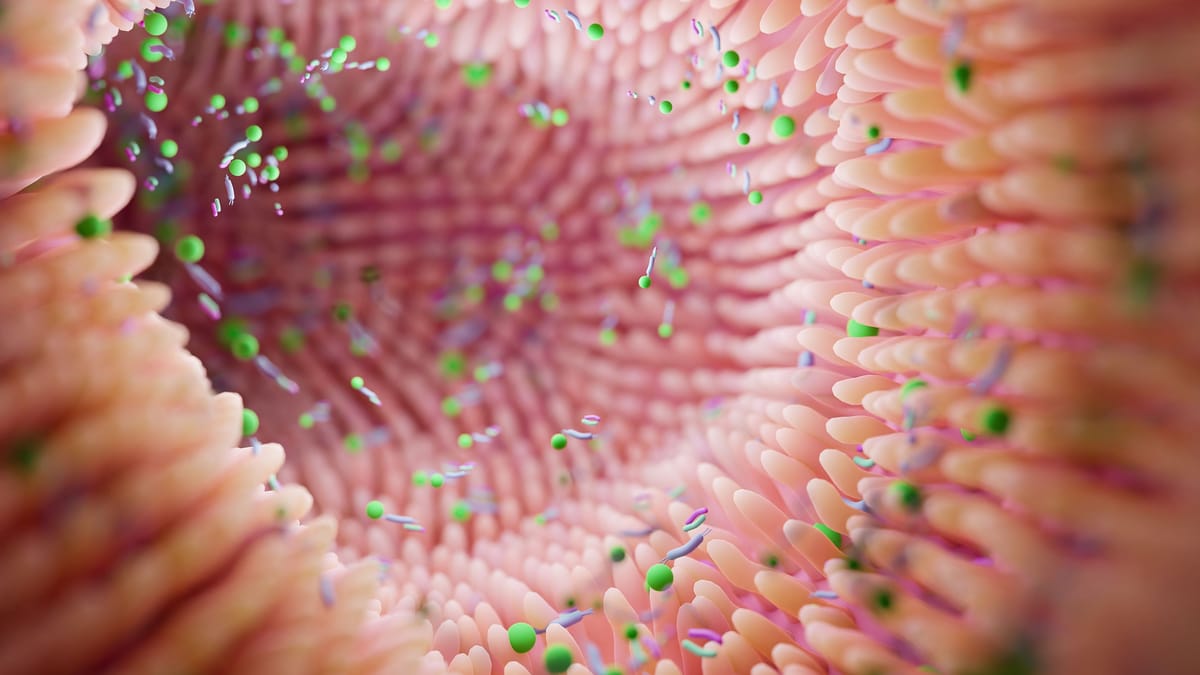 Morbus Crohn und Colitis ulcerosa: Darmerkrankungen nehmen weltweit zu
