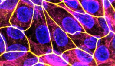 Die neuen Nanomedikamente zur Behandlung von Entzündungsprozessen in der Schwangerschaft sollen eine sichere Therapie für Mutter und Kind bieten. Im Bild: Das Plazenta-Modell unter dem Fluoreszenzmikroskop (blau: Zellkerne; gelb: Zell-zu-Zell-Kontakte).