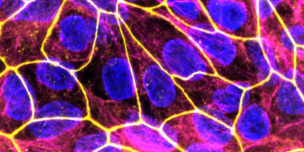 Die neuen Nanomedikamente zur Behandlung von Entzündungsprozessen in der Schwangerschaft sollen eine sichere Therapie für Mutter und Kind bieten. Im Bild: Das Plazenta-Modell unter dem Fluoreszenzmikroskop (blau: Zellkerne; gelb: Zell-zu-Zell-Kontakte).