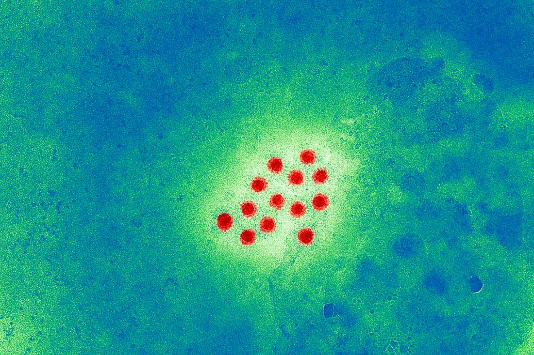 HEPATITIS A VIRUS auf abstrakten Hintergrund, 30.8.2022