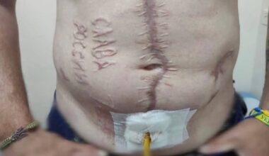 Grausame Folter: Russen brennen Ukrainer Parole in Bauch | Politik