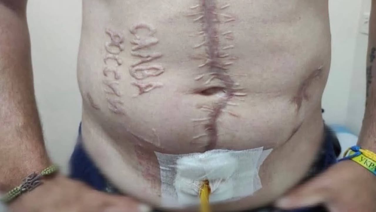 Grausame Folter: Russen brennen Ukrainer Parole in Bauch | Politik