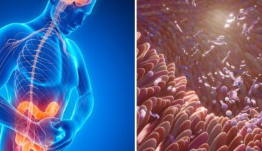 Globale Ausbreitung von Morbus Crohn und Colitis
