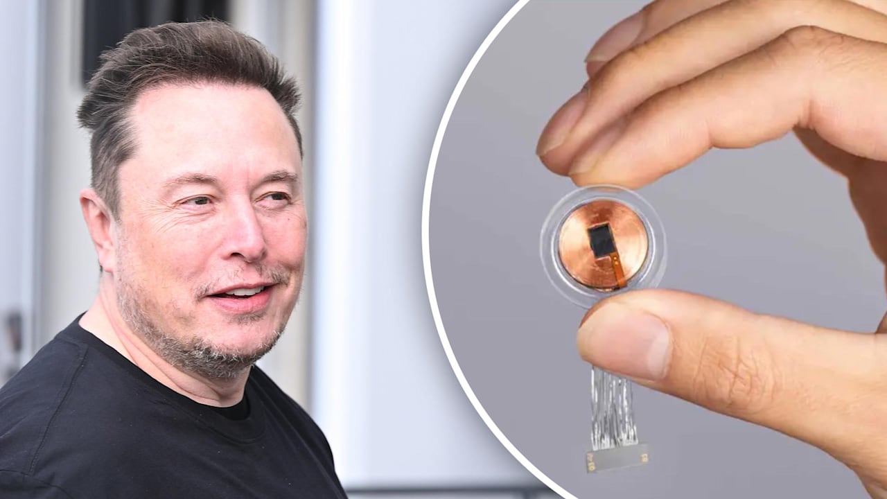 Elon Musk: Neuralink erhält 650 Mio. Dollar für Chip-Implantate | Geld