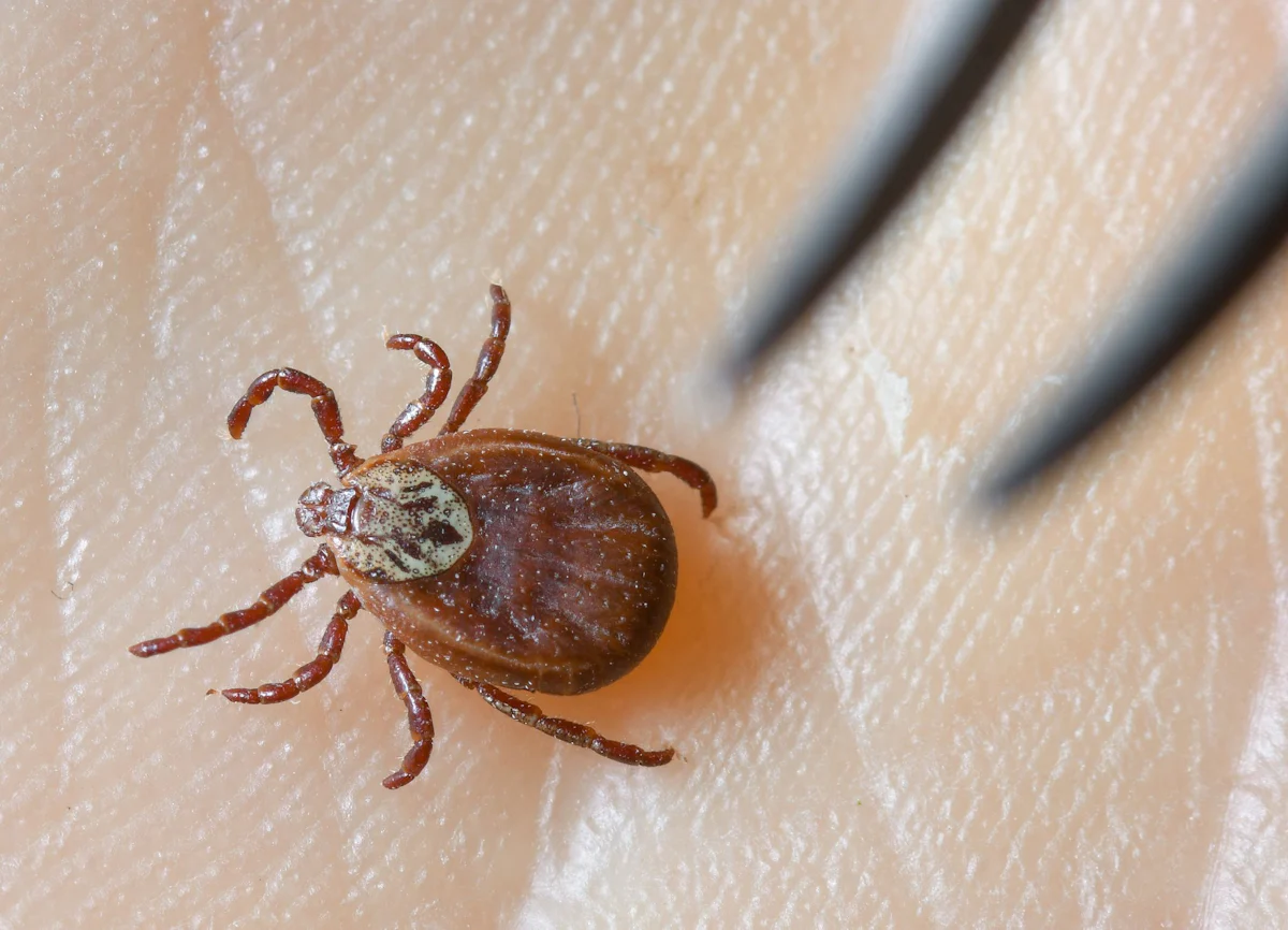 Krankheiten - Zeckensaison: Mehr Borreliose-Fälle in Berlin als früher - Gesundheit