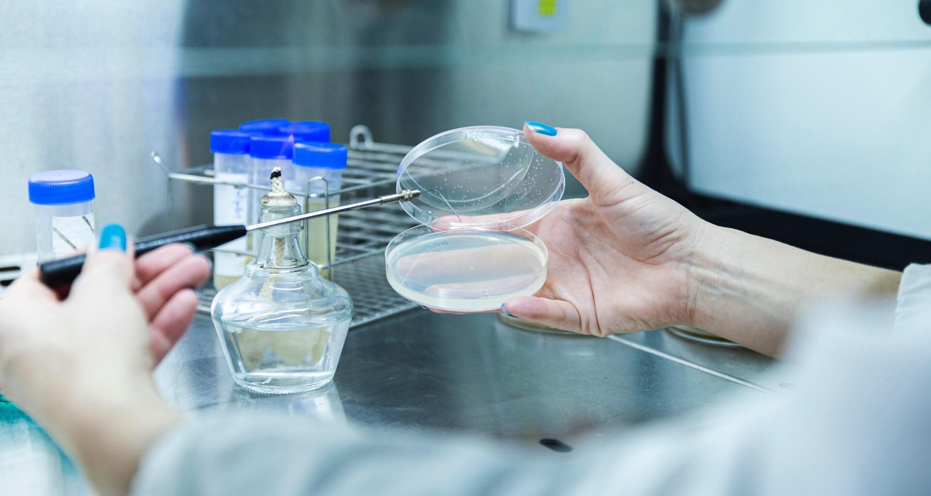Eine Frau mit blauem Nagellack hält mit der rechten Hand eine Petrischale. Mit der linken führt sie eine Pipette, mit der sie vermutlich etwas in die Schale füllt.