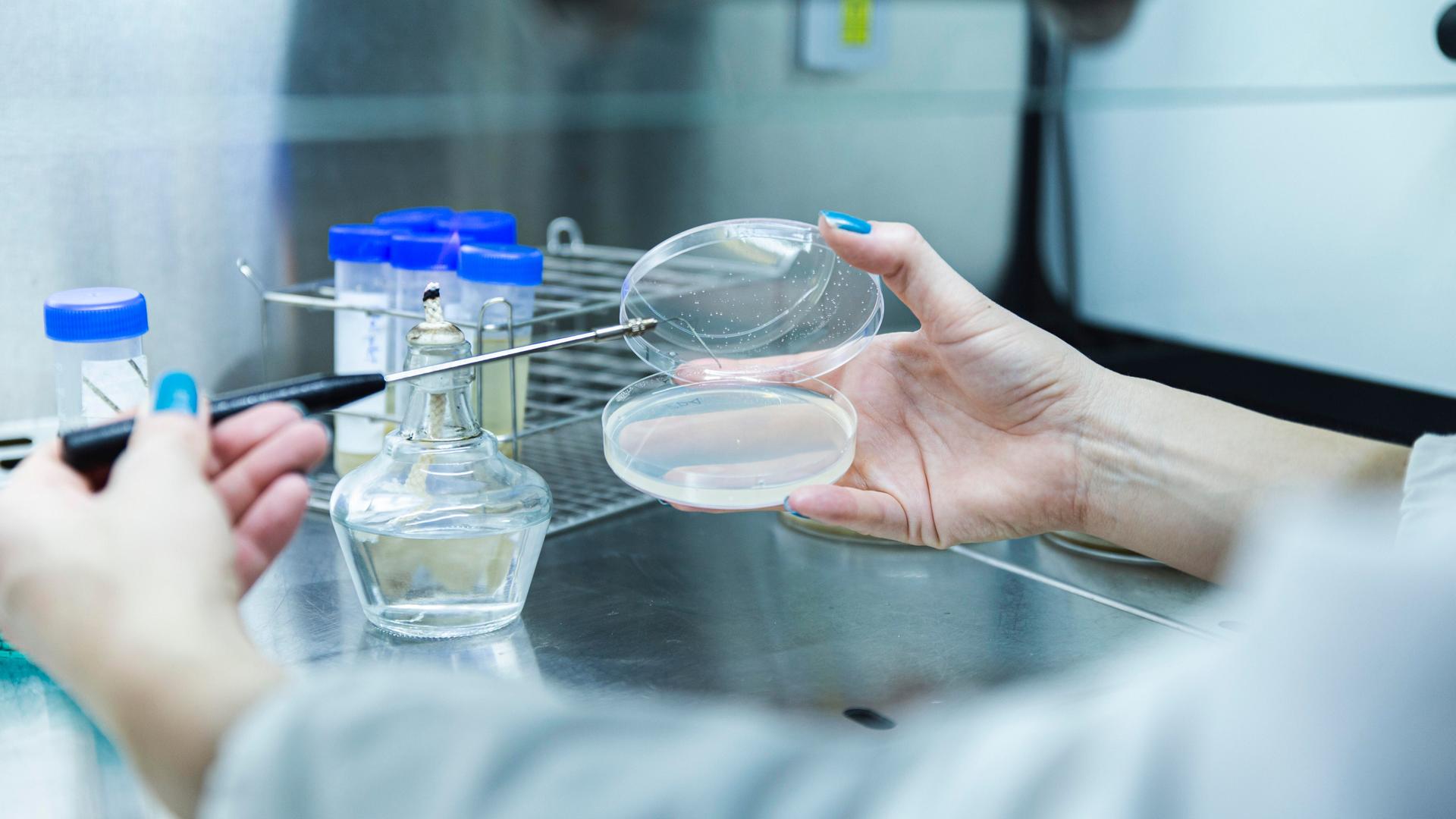 Eine Frau mit blauem Nagellack hält mit der rechten Hand eine Petrischale. Mit der linken führt sie eine Pipette, mit der sie vermutlich etwas in die Schale füllt. 