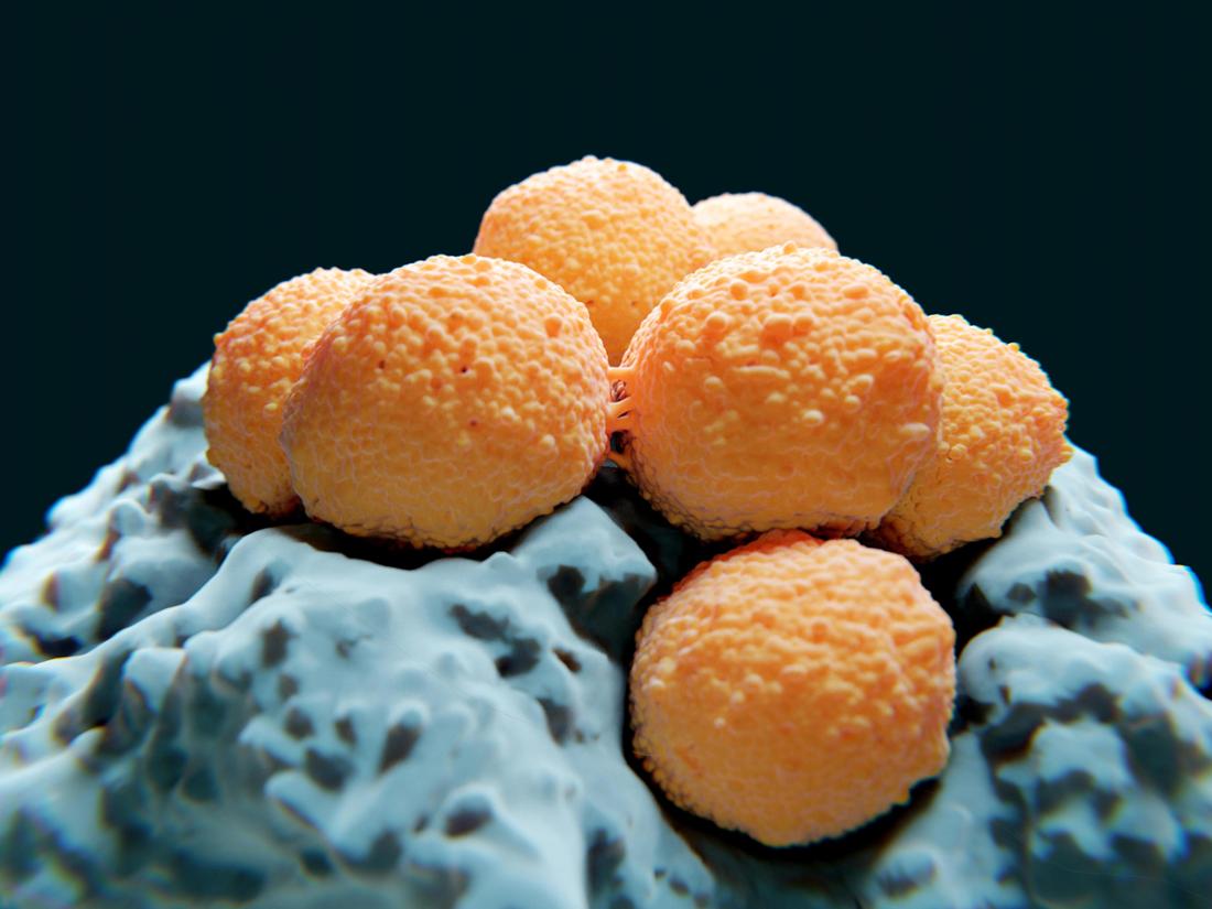 Streptococcus Bakterien