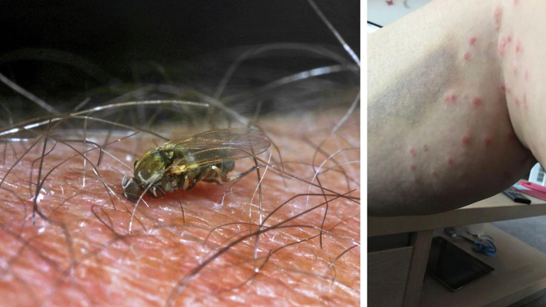 Kriebelmücken sind keine harmlosen Plagegeister: Die winzigen Blutsauger mit gefährlichen Zähnchen breiten sich in Deutschland aus. 