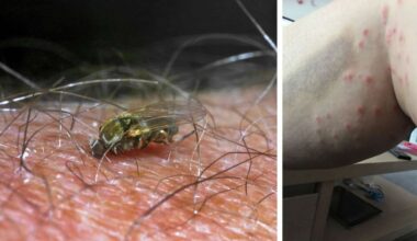 „Musste Antibiotikum nehmen“ – gefährliche Sommer-Plage tobt in Deutschland