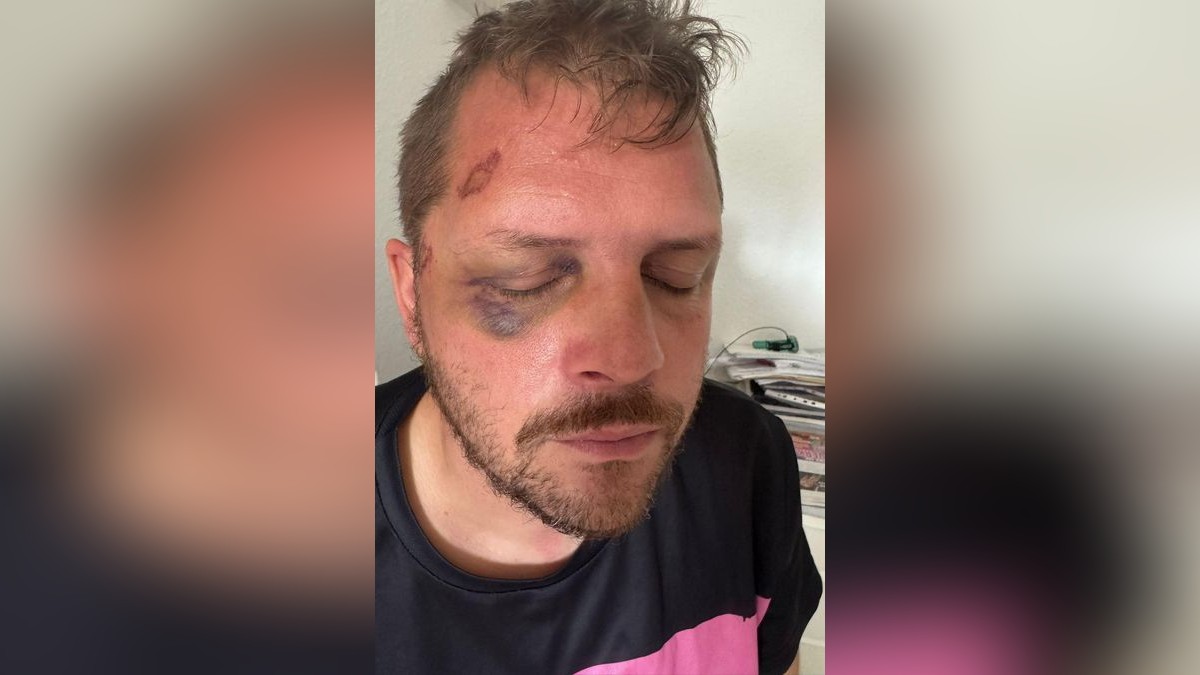 Sven Liesegang aus Gelsenkirchen ist nach dem Sommerfest Schloss Berge Opfer eines Überfalls geworden.