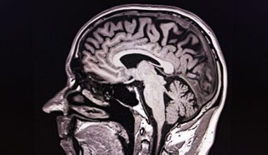 Mit Hirnscan aus der Lebensmitte: Neues KI-Tool sagt individuelles Sterberisiko voraus