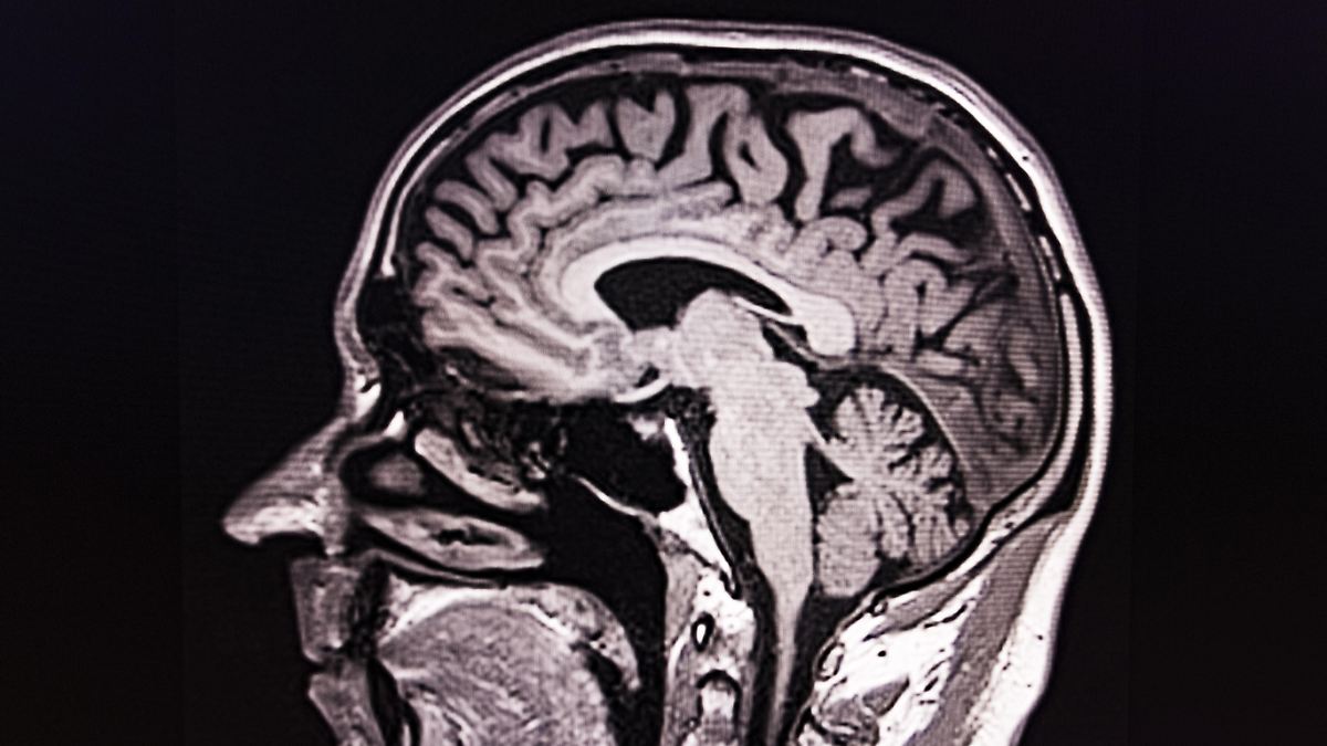 Mit Hirnscan aus der Lebensmitte: Neues KI-Tool sagt individuelles Sterberisiko voraus