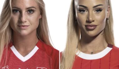 Frauen-EM: Alisha Lehmann: Beauty-Doc erklärt die krasse Veränderung | Sport