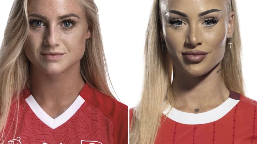 Frauen-EM: Alisha Lehmann: Beauty-Doc erklärt die krasse Veränderung | Sport