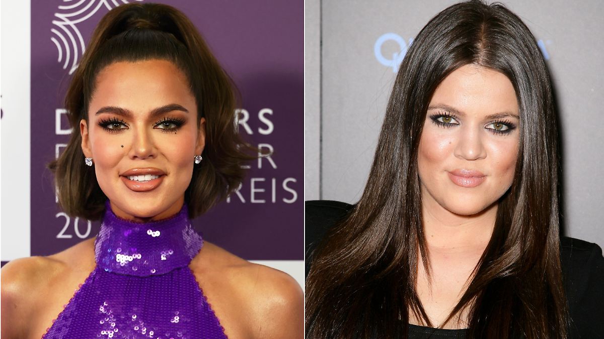 Schonungslos ehrlich: Khloé Kardashian listet alle ihre Beauty-Eingriffe auf