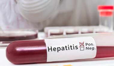 Um Hepatitis C zu eliminieren, sind alle Instrumente vorhanden. Geht es in dem Tempo weiter, wird Deutschland das Ziel der WHO, die Zahl der Neuinfektionen bis 2030 um 90 Prozent zu senken, nicht erreichen. Foto: ©iStock.com/vchal