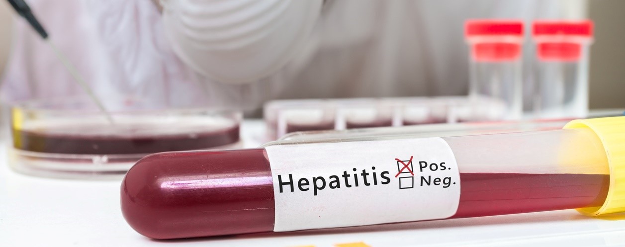 Um Hepatitis C zu eliminieren, sind alle Instrumente vorhanden. Geht es in dem Tempo weiter, wird Deutschland das Ziel der WHO, die Zahl der Neuinfektionen bis 2030 um 90 Prozent zu senken, nicht erreichen. Foto: ©iStock.com/vchal