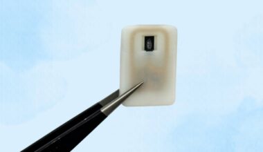 Diabetes Typ 1: MIT entwickelt Notfallimplantat für Diabetiker