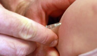 Der Tag: USA erleben schlimmste Masern-Epidemie seit mehr als 30 Jahren
