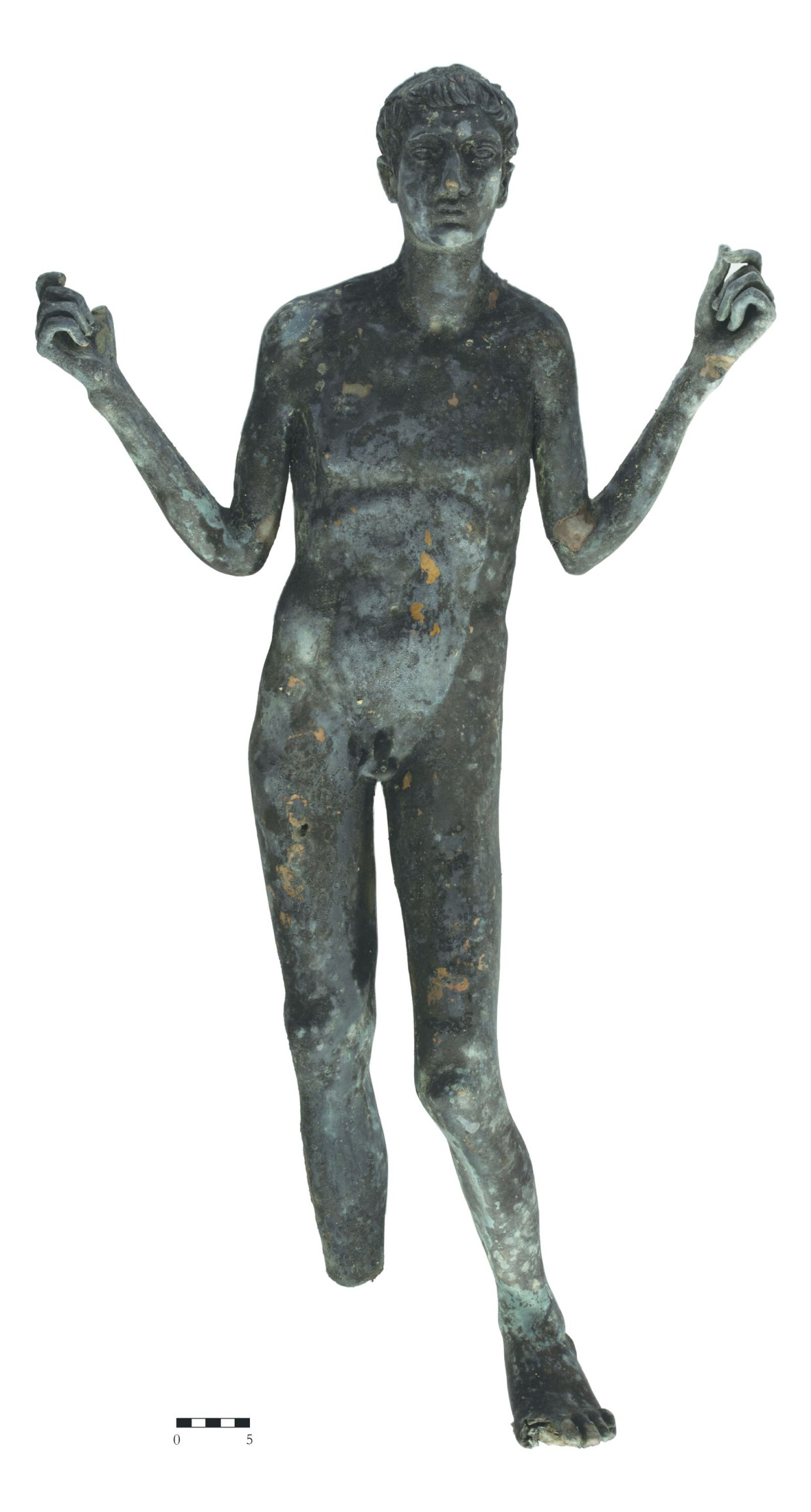 Der Kranke als Kunstwerk: Bronzestatue des Lucius Marcius Grabillo, 1. Jahrhundert nach Christus