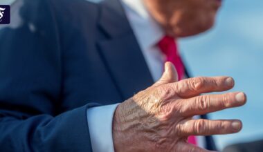 Liveblog USA unter Trump: Trump hat chronische Erkrankung der Beinvenen