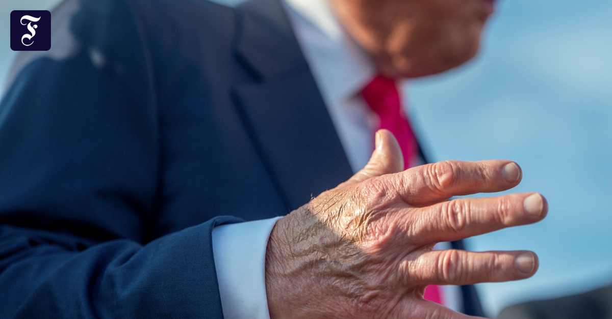 Liveblog USA unter Trump: Trump hat chronische Erkrankung der Beinvenen