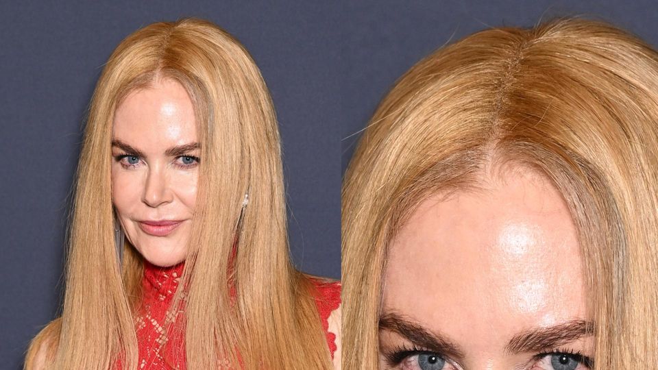 Nicole Kidman im Mai 2025 in Cannes. Auch wenn ihre Haare sehr natürlich aussehen, erkennt man dennoch das Netz der Perücke, in das die falschen Haare eingearbeitet sind. 