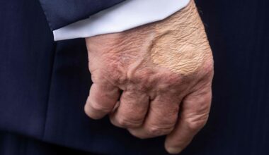 Donald Trump: Seltsamer Fleck an der Hand sorgt für Spekulationen – Weißes Haus gibt Erklärung ab