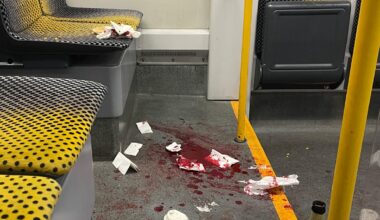 Messerangriff auf US-Bürger in Dresden: Amerikaner nennen es „Bloody hell“ | Regional
