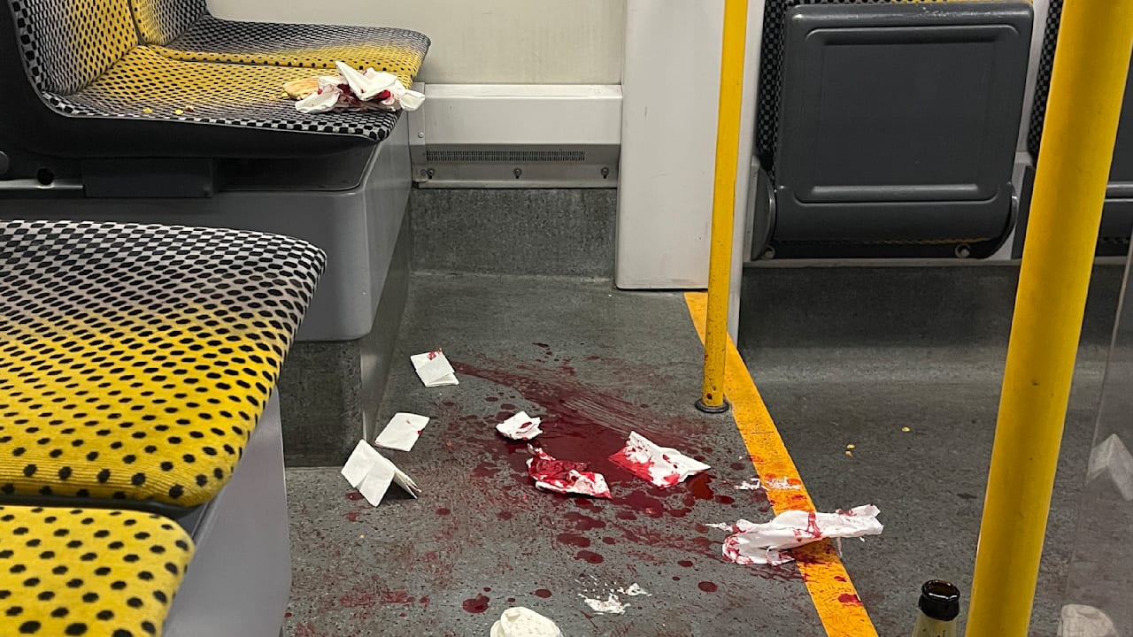 Messerangriff auf US-Bürger in Dresden: Amerikaner nennen es „Bloody hell“ | Regional