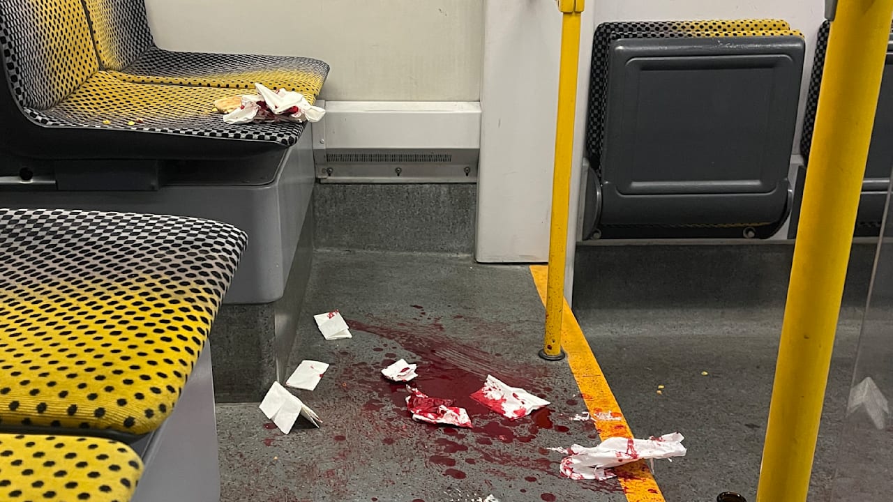 Messerangriff in Dresden: US-Bürger niedergestochen, Syrer festgenommen | Regional