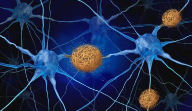Lithiummangel eine Erklärung für Alzheimer und möglicher Therapieansatz? – News – Deutsches Ärzteblatt