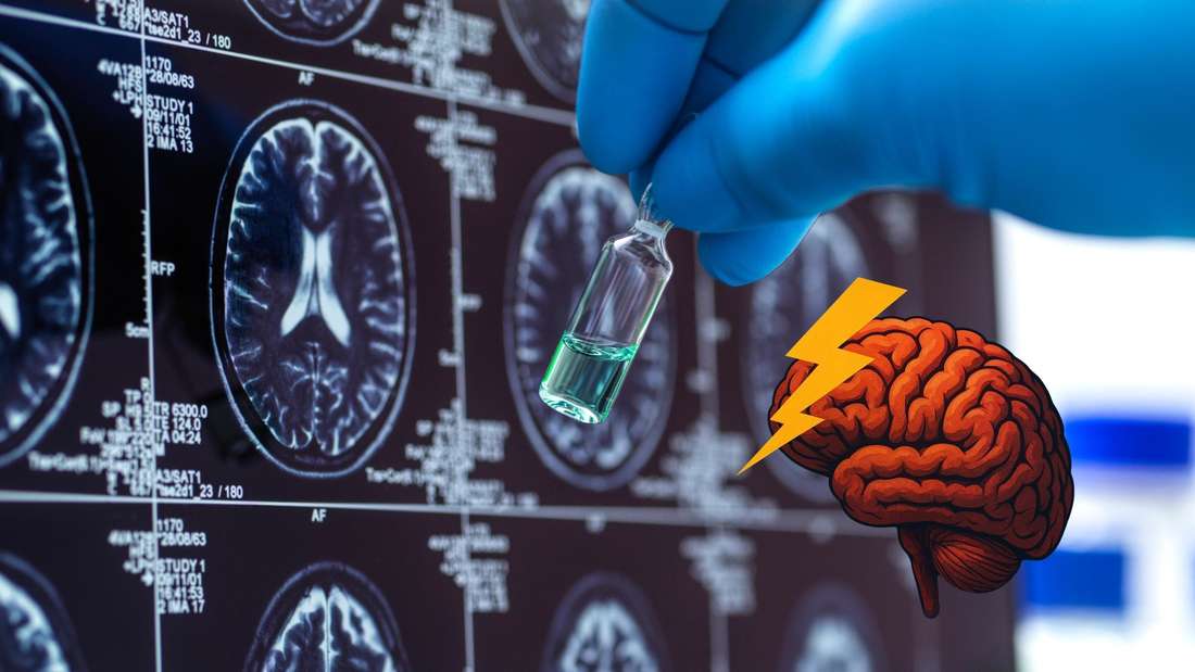 Umfassende Studie verknüpft Nährstoffmangel mit beschleunigtem Alzheimer-Verlauf.