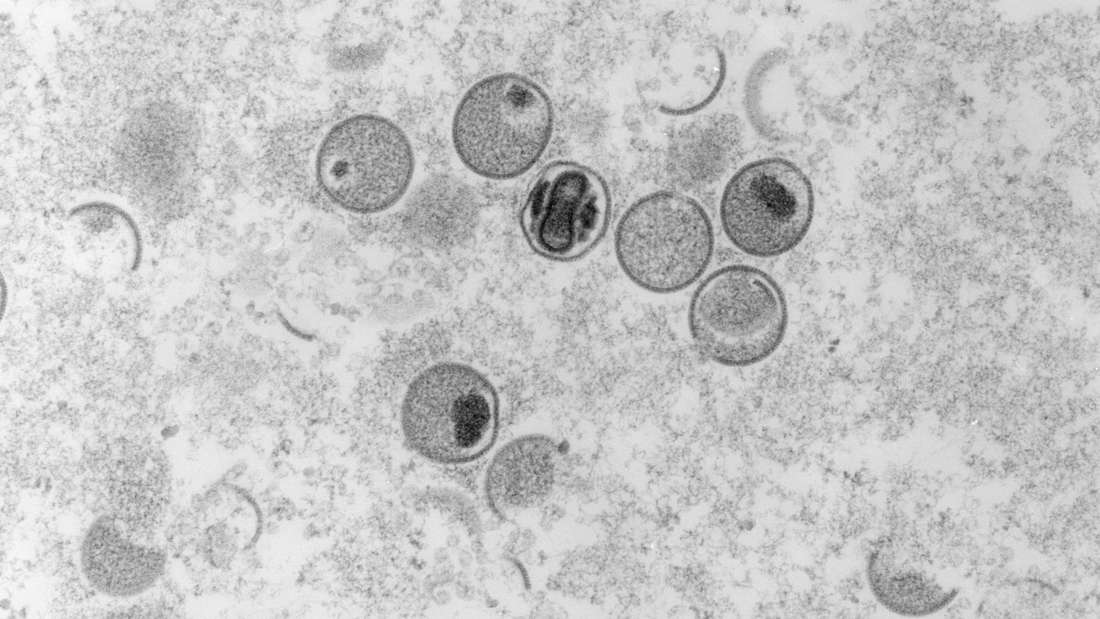 Das Affenpockenvirus ist verwandt mit den klassischen humanen Pockenviren – sogenannte Variola oder Smallpox – und den ebenfalls als Zoonose bekannten Kuhpockenviren. 