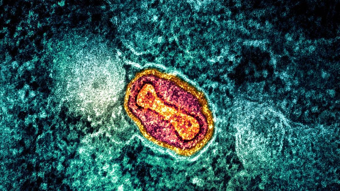 Ein Mpox Virus auf infizierten Hintergrund. Mpox breiten sich rasant aus.
