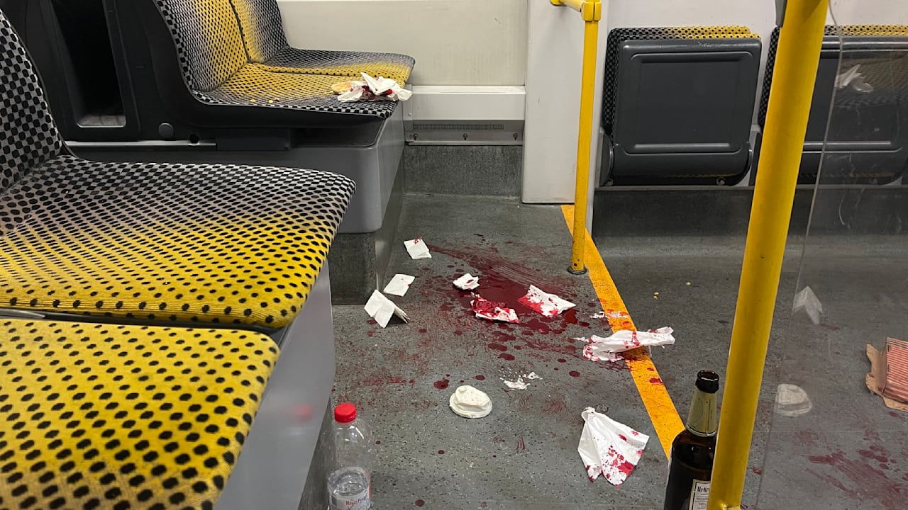 Dresden: Amerikaner schützt Frau und wird brutal niedergestochen | Regional