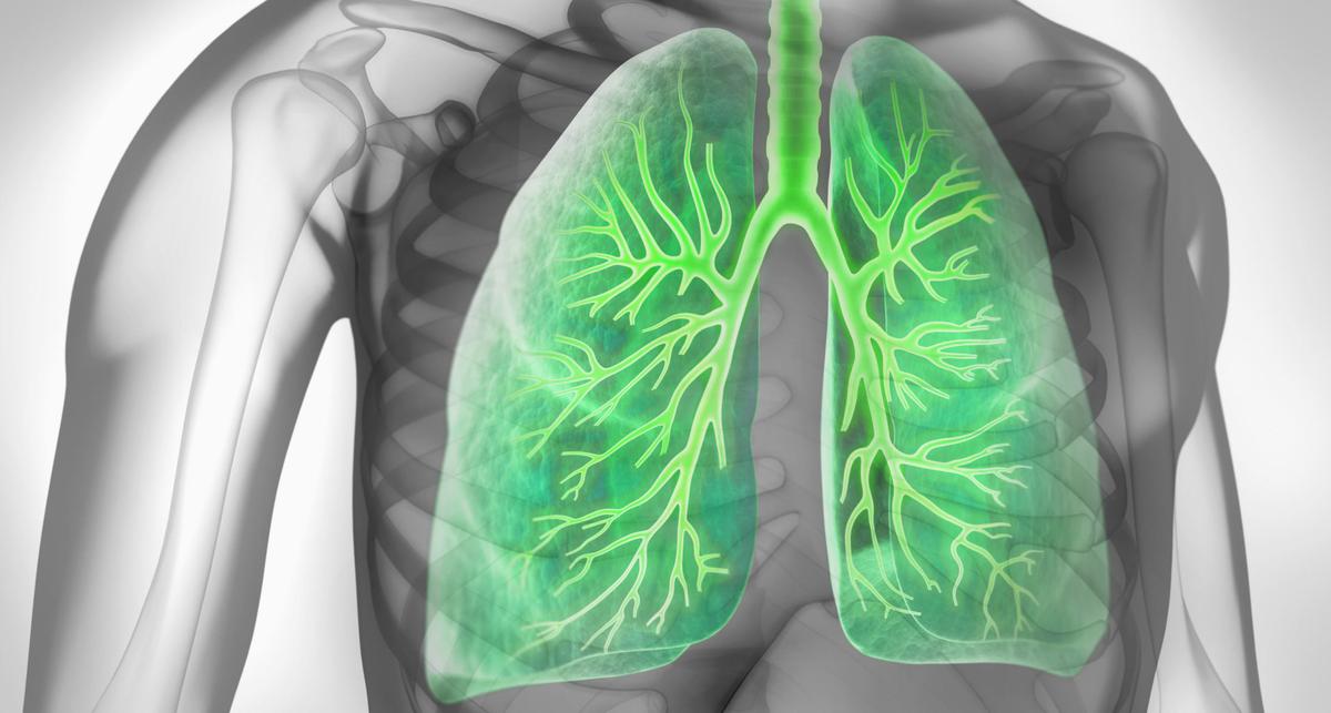 Die wichtigsten globalen Faktoren für Prävalenz und Mortalität von COPD – News – Deutsches Ärzteblatt