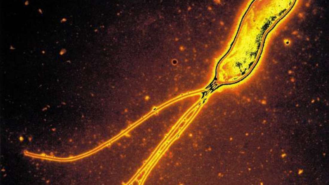 Das Magenbakterium Helicobacter pylori 