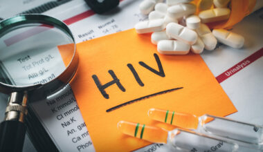 HIV