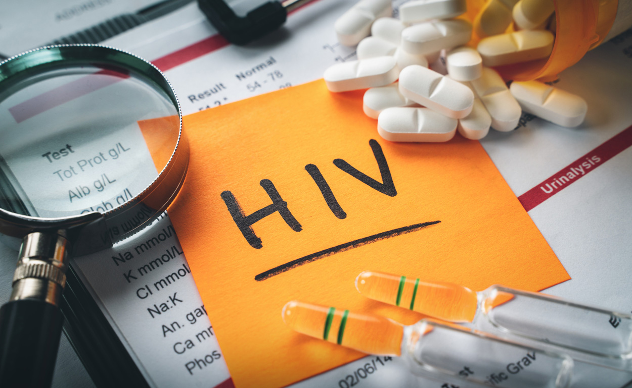 HIV