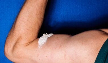 Kreatin nützlich oder nicht? Georgsmarienhütter Arzt klärt auf