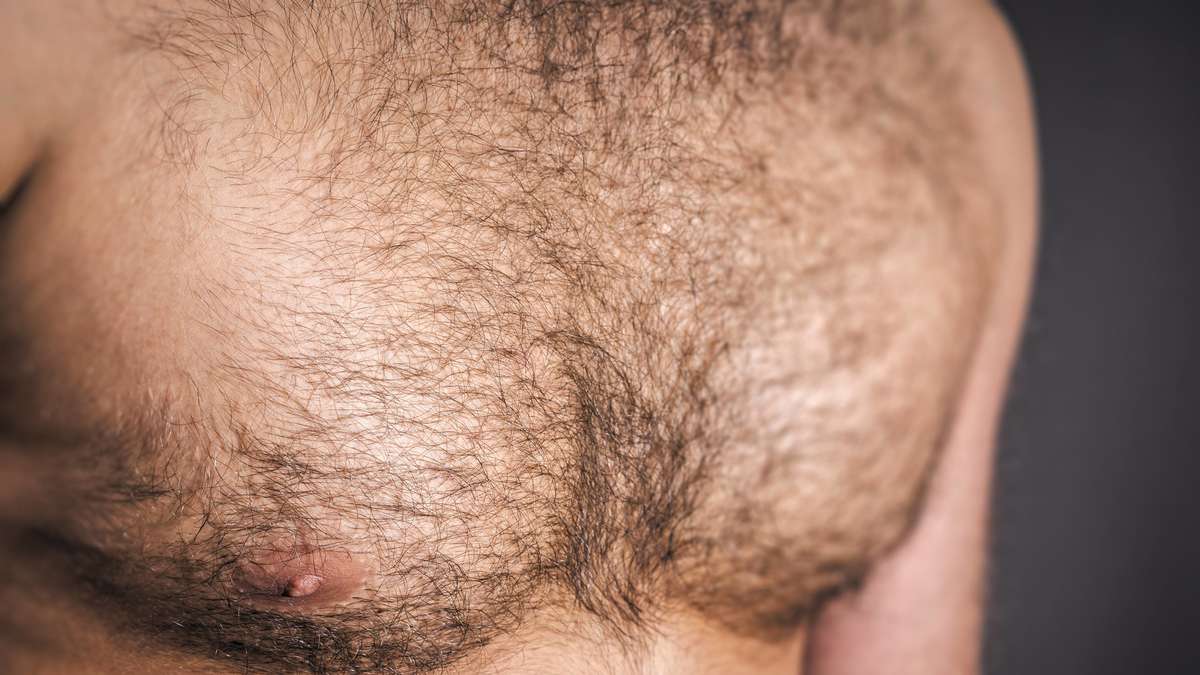 Brustkrebs bei Männern wird häufig erst spät erkannt