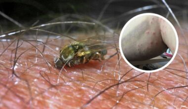 Tückische Insekten-Plage in Deutschland – „musste schon Antibiotikum nehmen“